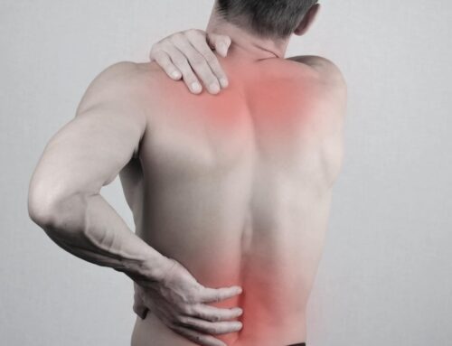 How to Use CBD Oil Topically for Back Pain